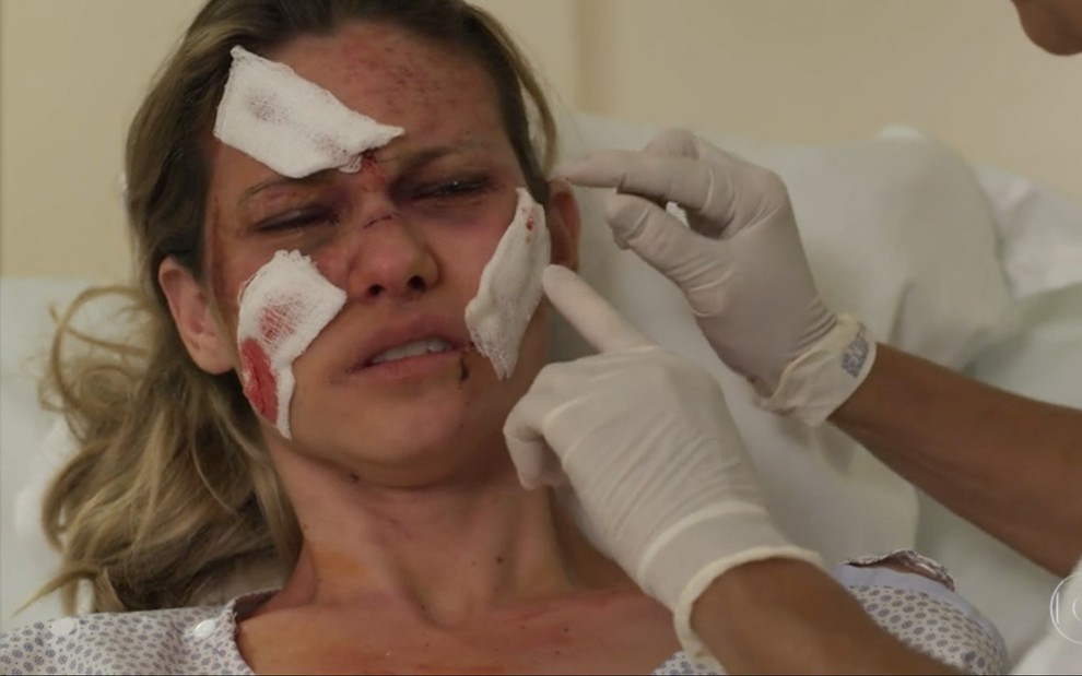 Karen Junqueira caracterizada como Jéssica em Haja Coração: deitada em cama do hospital, atriz está cheia de ataduras e cicatrizes no rosto