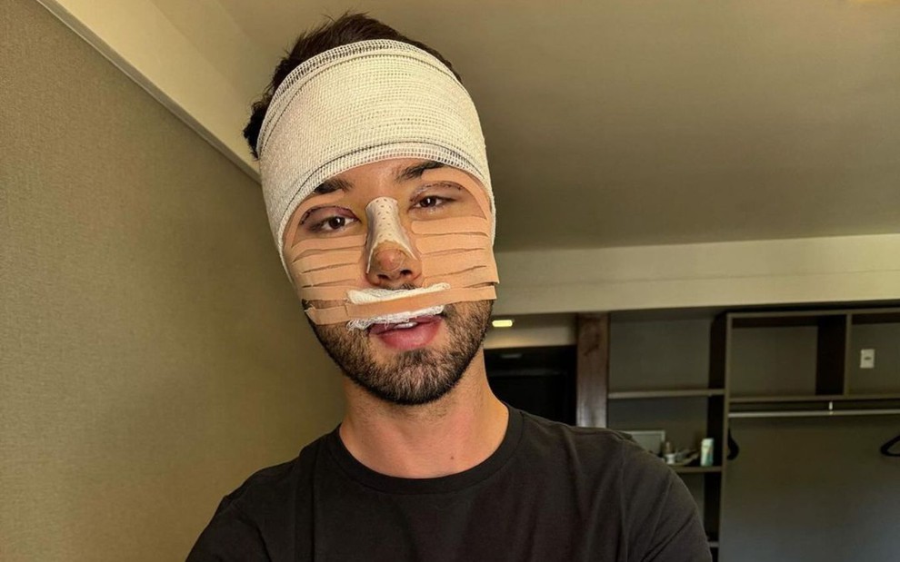 Rico Melquiades com o rosto enfaixado após cirurgias plásticas