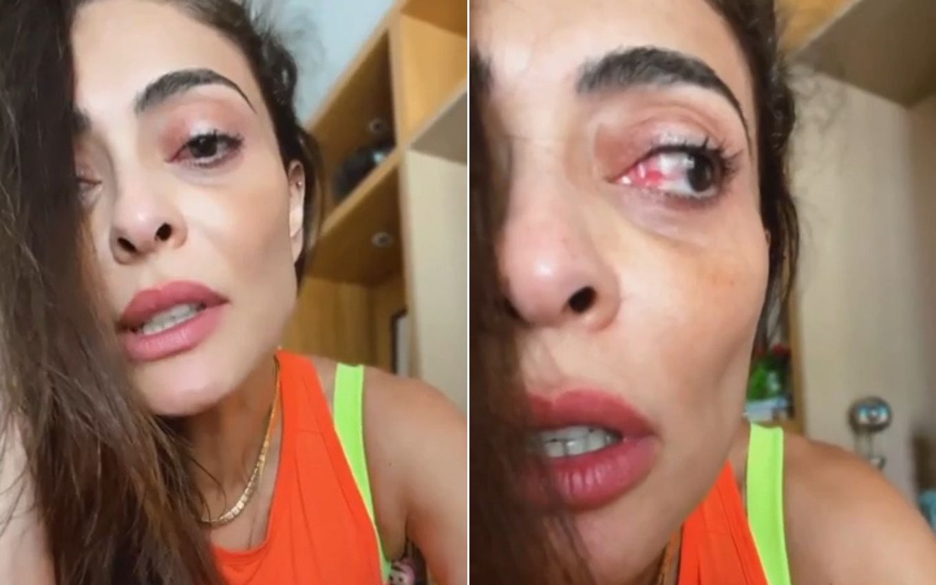 Juliana Paes Preocupa Seguidores Ao Surgir Olho Vermelho E Inchado