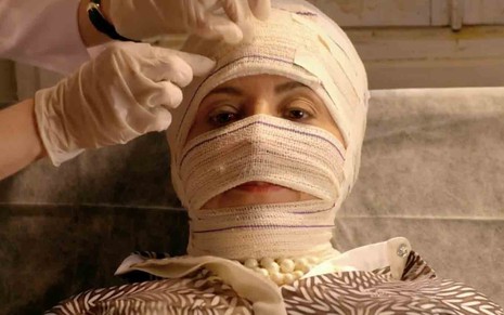 Com a cabeça cheia de faixas, como uma múmia, a atriz Claudia Netto grava cena de Flor do Caribe, da TV Globo