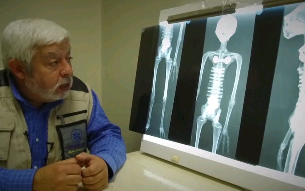 Vestido com camisa azul e um colete de fotógrafo, Jaime Maussan observa raio-x de supostas múmias