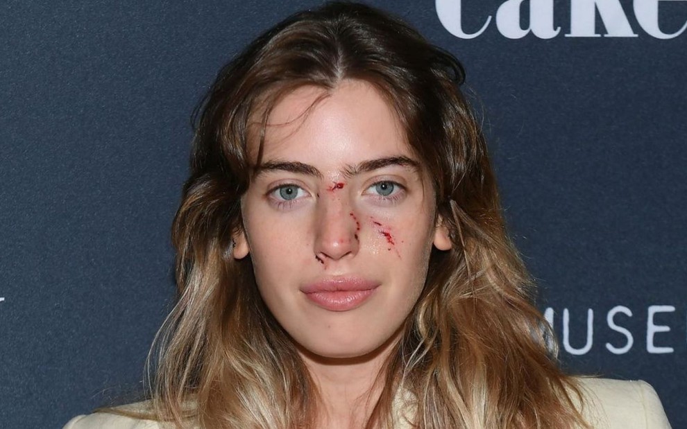 A atriz Clara McGregor posou com machucados no rosto na pré-estreia do filme The Birthday Cake, com backdrop ao fundo