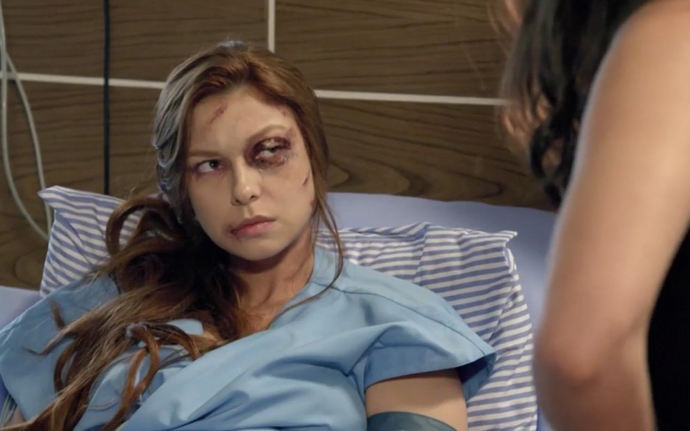 A atriz Day Mesquita com o rosto cheio de hematomas em uma cama de hospital como Poderosa em cena de Amor Sem Igual