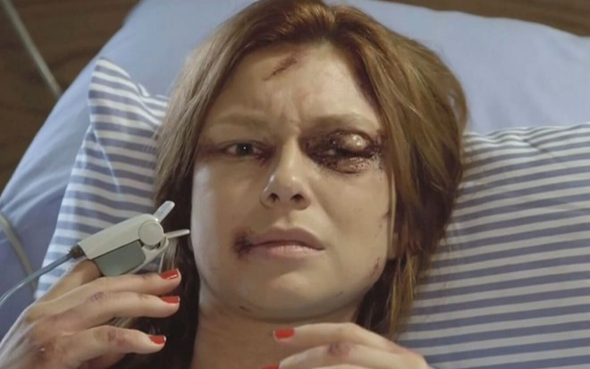 Poderosa (Day Mesquita) com rosto espancado está deitada em cama de hospital, em cena da novela Amor Sem Igual