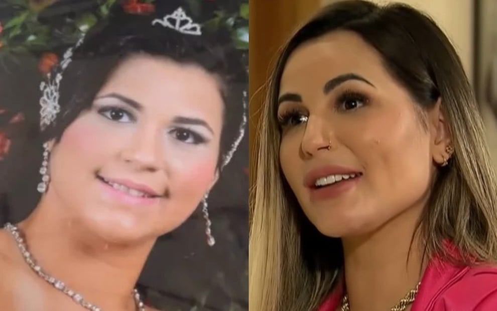 Antes e depois: Deolane Bezerra abre o jogo sobre cirurgias