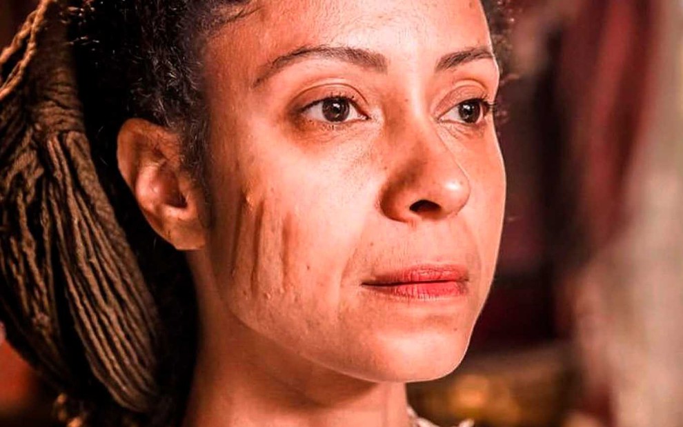 A atriz Cinnara Leal, com três cicatrizes em forma de risco vertical na bochecha, como Justina em cena de Nos Tempos do Imperador