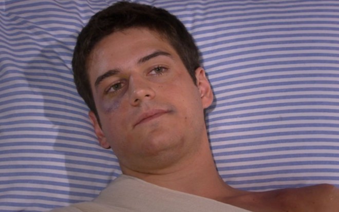 Marco Pigossi caracterizado como Pedro em cena de Ti Ti Ti: ator está em camisa de hospital, em close, com olho roxo e braço enfaixado