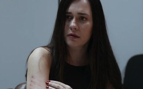 A atriz Alessandra Negrini como Guida mostra um hematoma em cena de Travessia