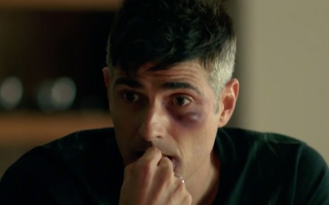 O ator Reynaldo Gianecchini como o personagem Anthony, que olha preocupado e tem um olho roxo, em cena da novela Verdades Secretas, da Globo