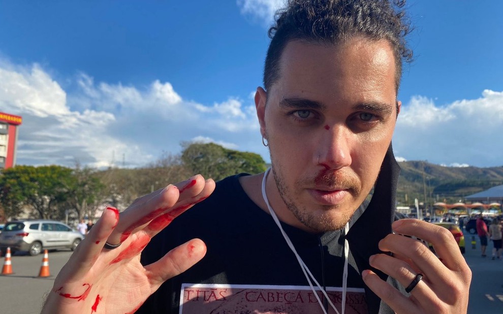 Imagem de Leandro Matozo, com sangue na mão, após ser agredido em Aparecida (SP)