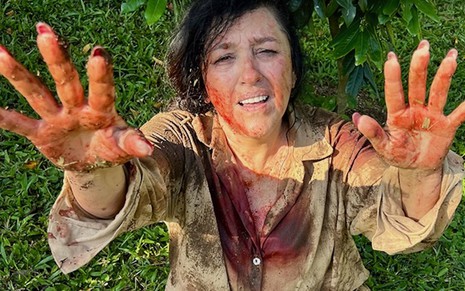 A atriz Regina Casé está mostrando mãos com sangue caracterizada como Zoé da novela Todas as Flores