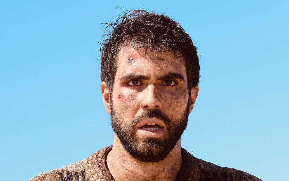 O ator Juliano Laham está o rosto com machucados já secos, mas que não foram cuidados, como José em cena de Gênesis