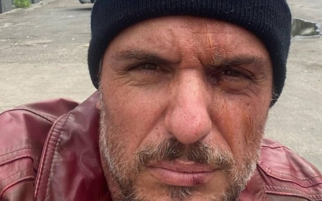 Ator Rodrigo Lombardi surge com cicatriz no rosto e olha para câmera
