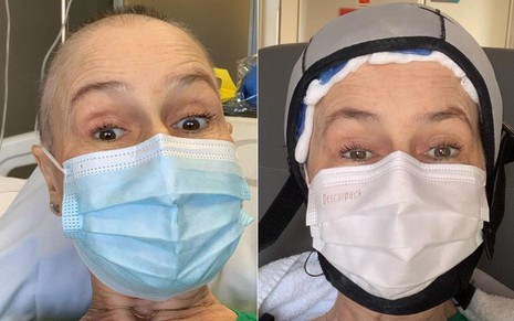 Montagem com fotos de Susana Naspolini de máscara durante quimioterapia