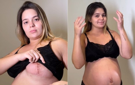 Fotos de Viih Tube erguendo o sutiã para mostrar pigmentação de cicatrizes e mostrando a barriga na gravidez
