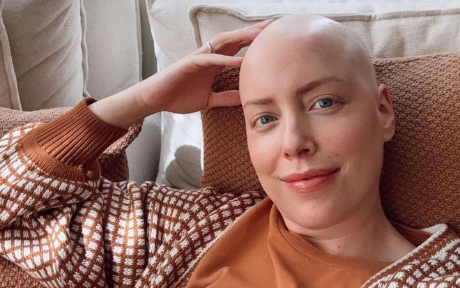 Fabiana Justus, com a cabeça raspada, em foto nas suas redes sociais