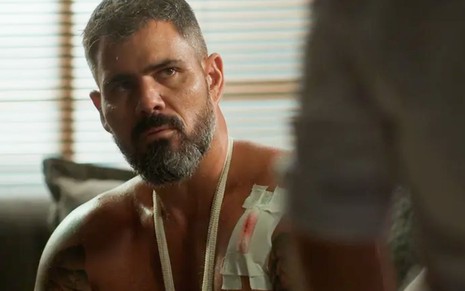 O ator Juliano Cazarré caracterizado como Pascoal cheio de feridas e curativos em cena de Fuzuê