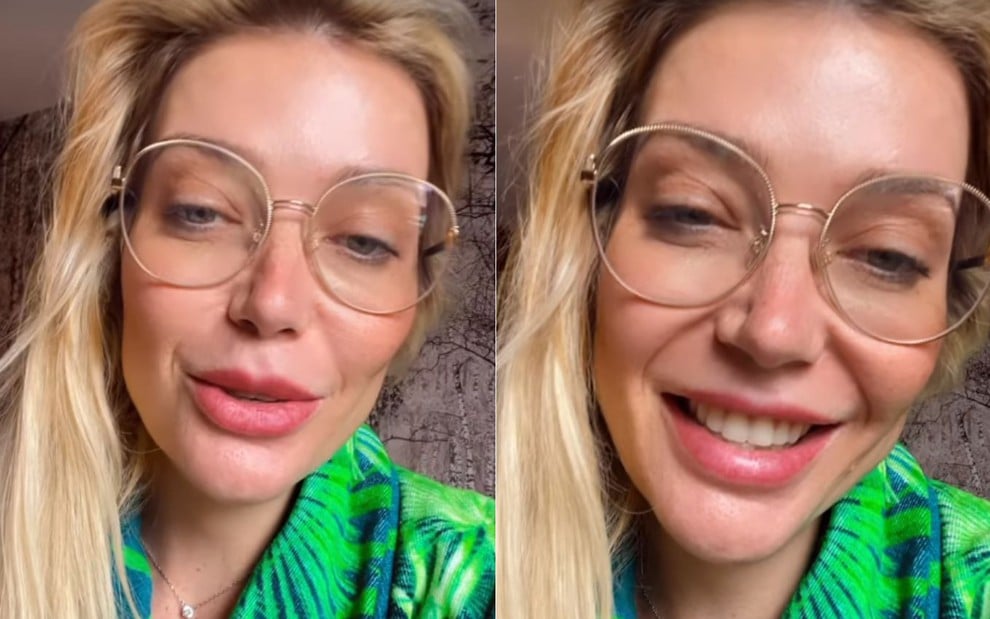 Montagem com duas imagens de Luiza Possi sorrindo, com preenchimento labial, usando óculos e camiseta verde