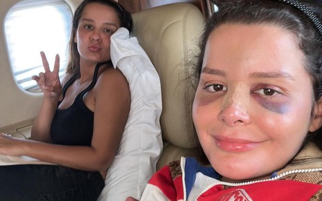 Maiara e Maraisa em jatinho, em foto publicada no Instagram na noite de sexta-feira (19), Maraisa de olho roxo e curativo no nariz