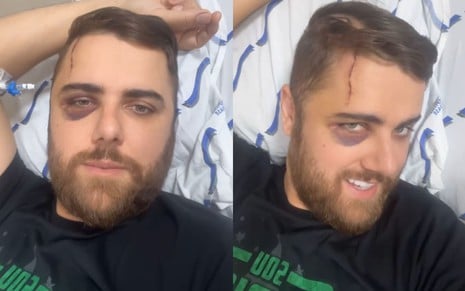 Zé Neto está com um hematoma no olho e usa uma camiseta preta; ele está deitado num leito de hospital