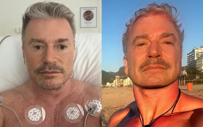 Edney Silvestre em pós-cirúrgico (à esquerda), e em caminhada após recuperação (direita)