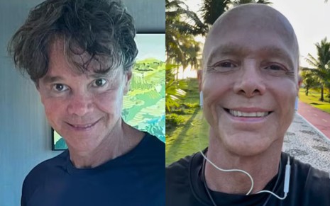 Na montagem está o cantor Netinho antes (à esquerda) e depois (à direita) de câncer