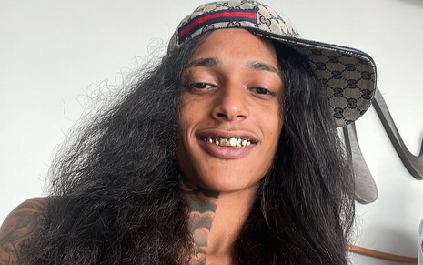Foto de Oruam com dentes dourados, boné e cabelos alisados