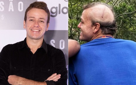 Montagem com Pablo Sanábio de braços cruzados em evento de Sob Pressão e outra foto dele com a cabeça raspada e cicatriz aparente
