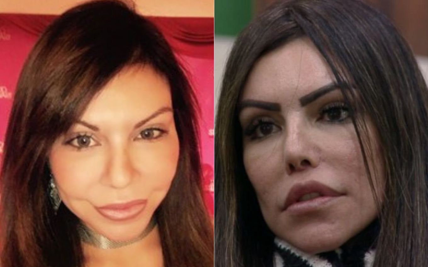 Liziane Gutierrez had plastic surgery that 'exploded' her face; s...