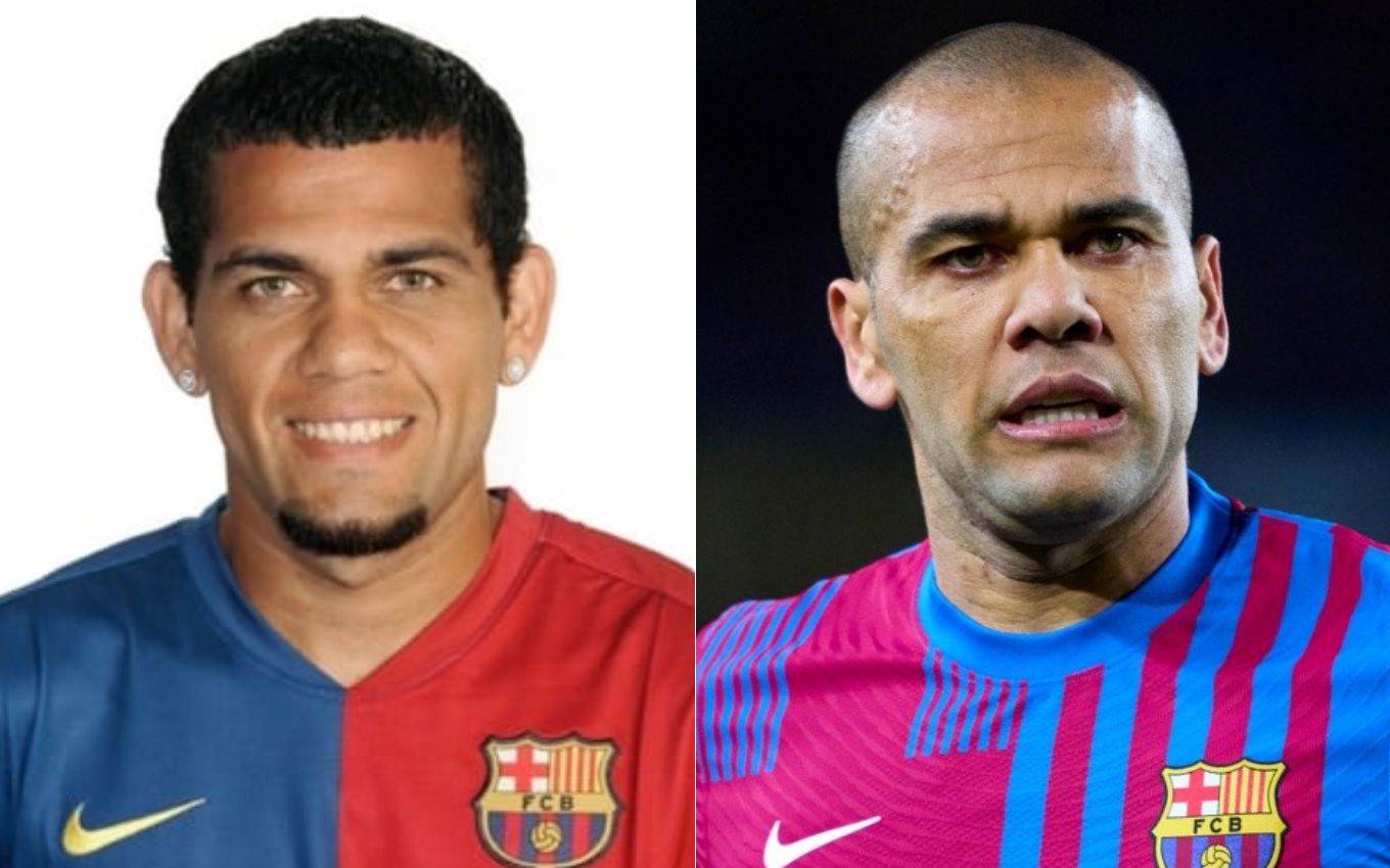 Daniel Alves antes e depois da otoplastia