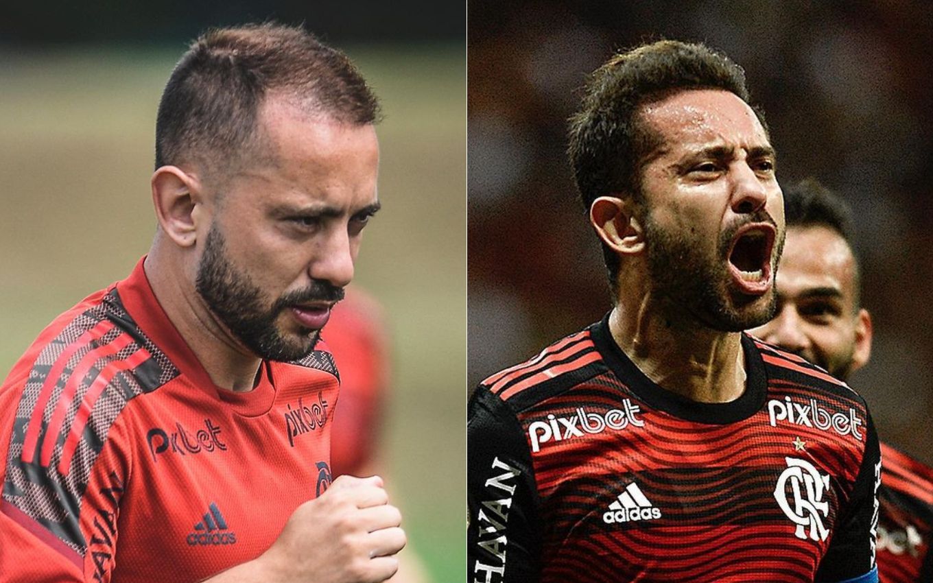 Everton Ribeiro antes e depois de tratamento capilar