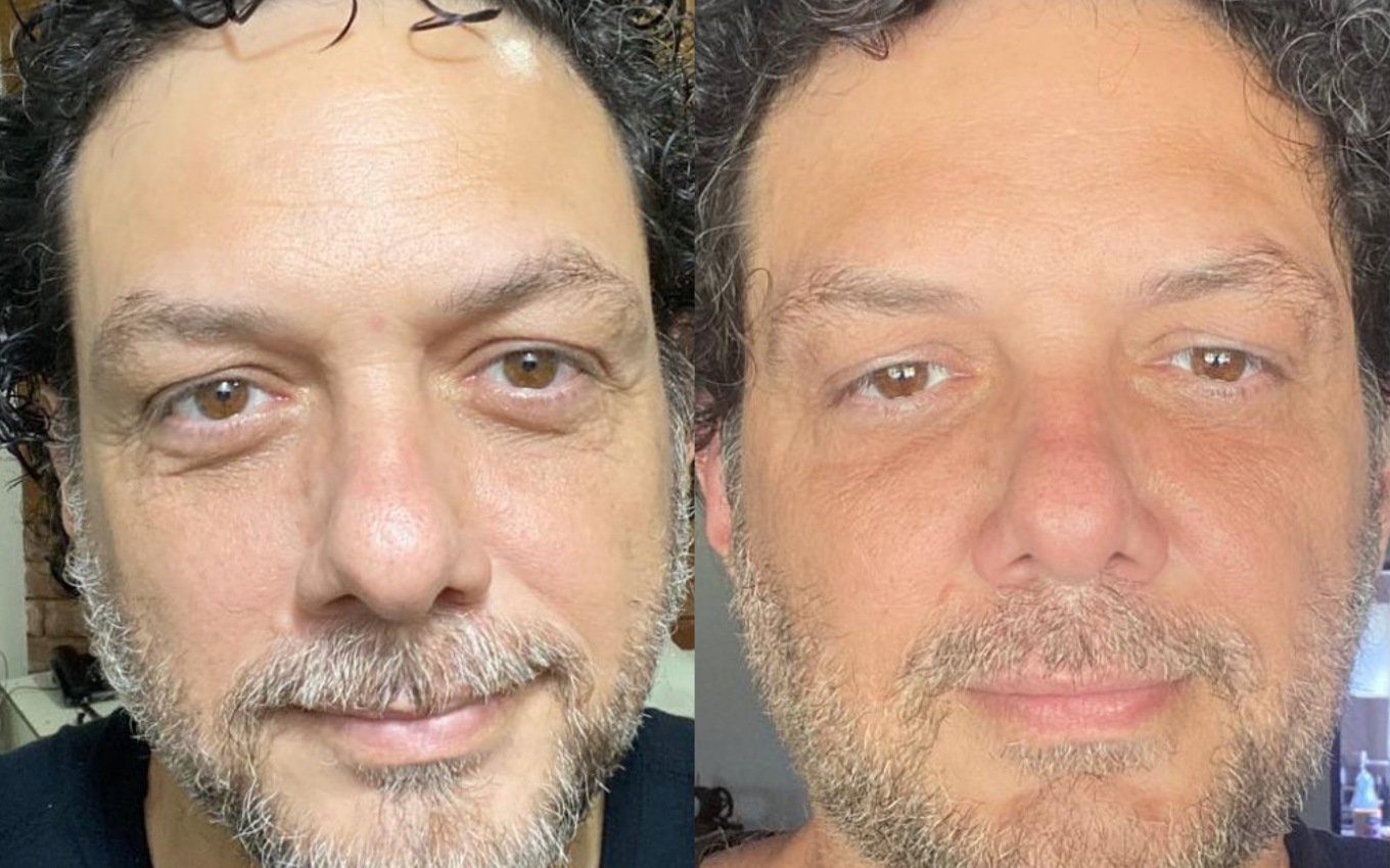 Antes e depois de Roobrtchay Rocha