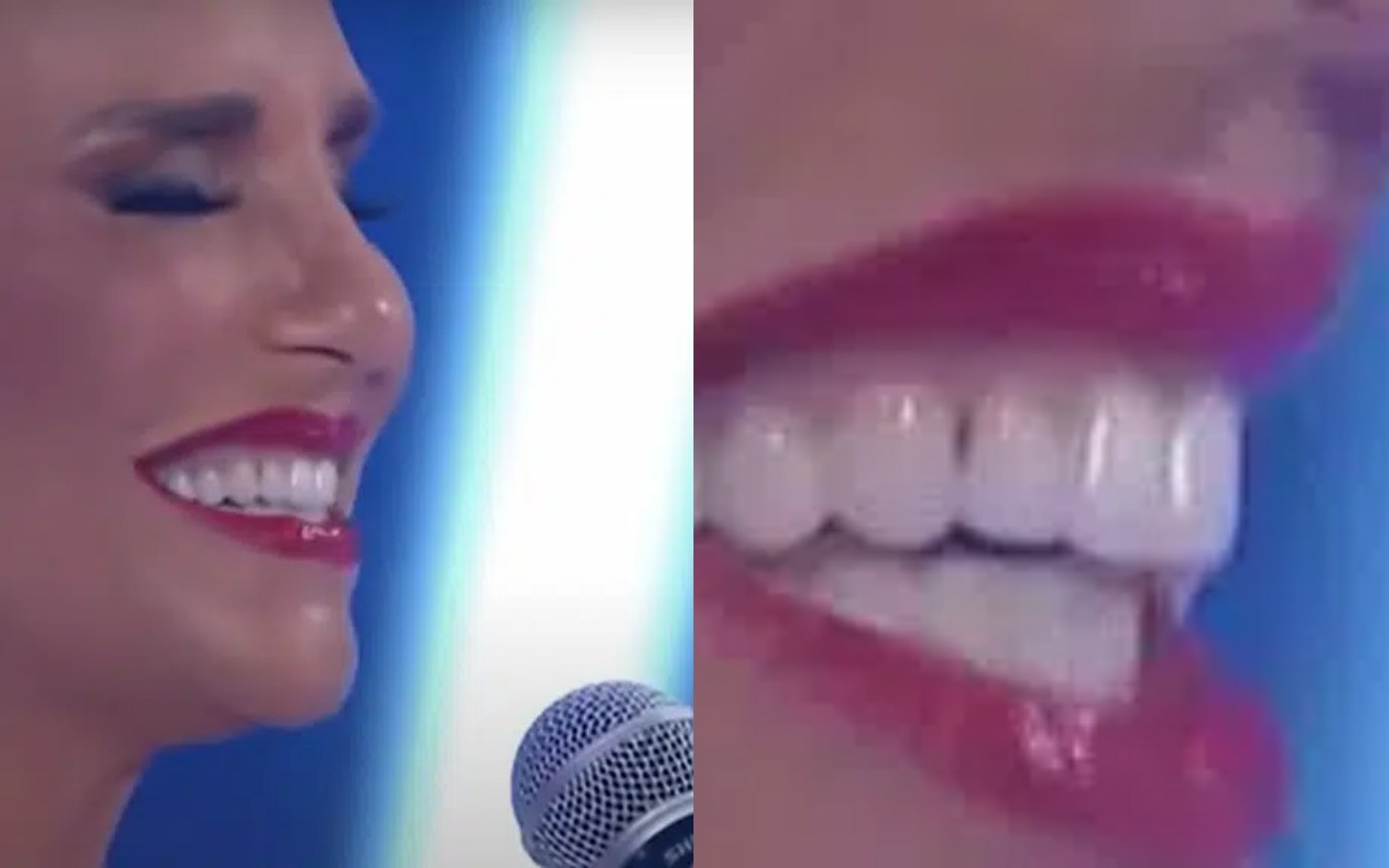 Ivete Sangalo exibe problemas dentais em apresentação com Roberto Carlos