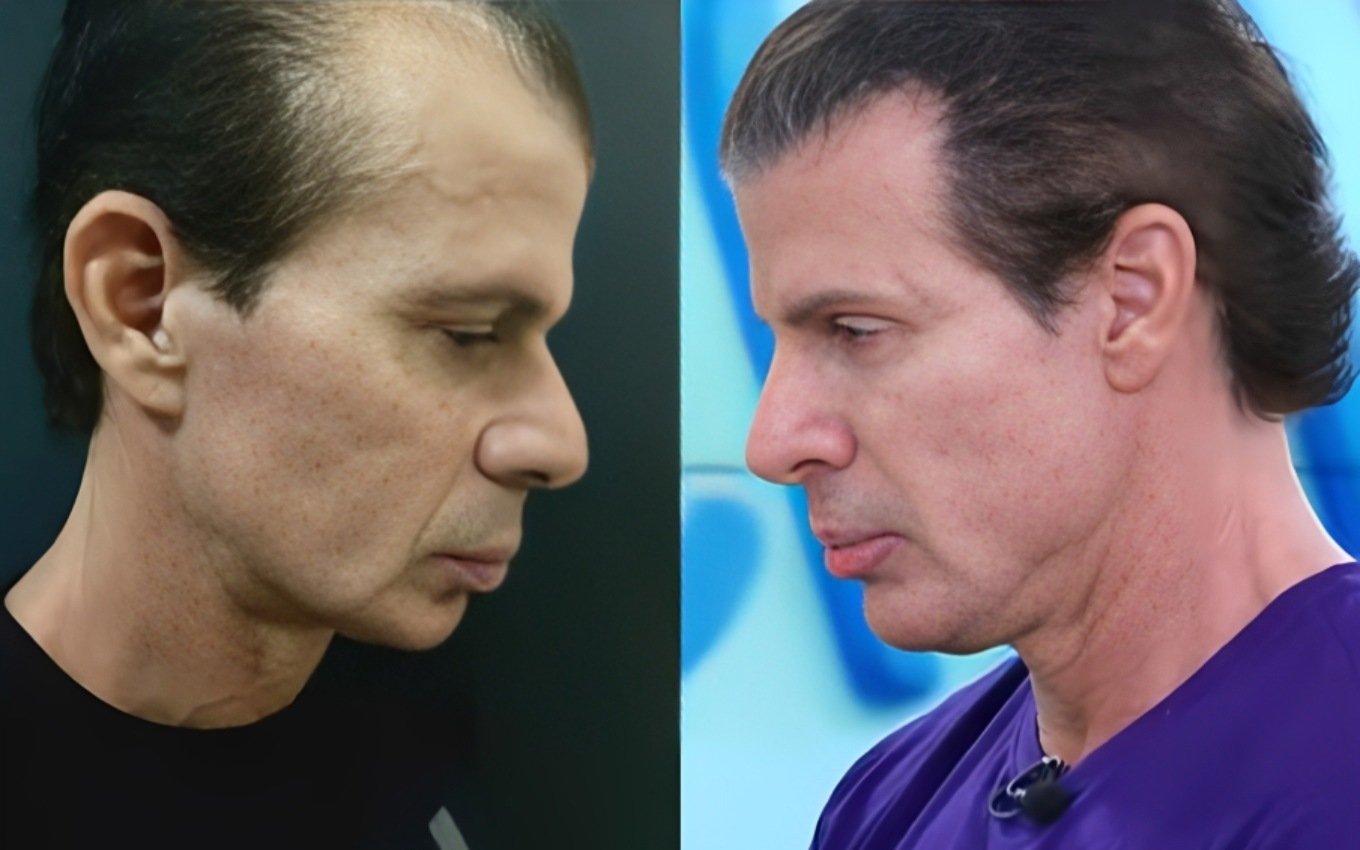 Túlio antes e depois