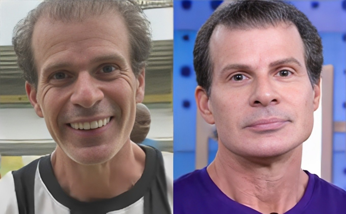 Túlio antes e depois