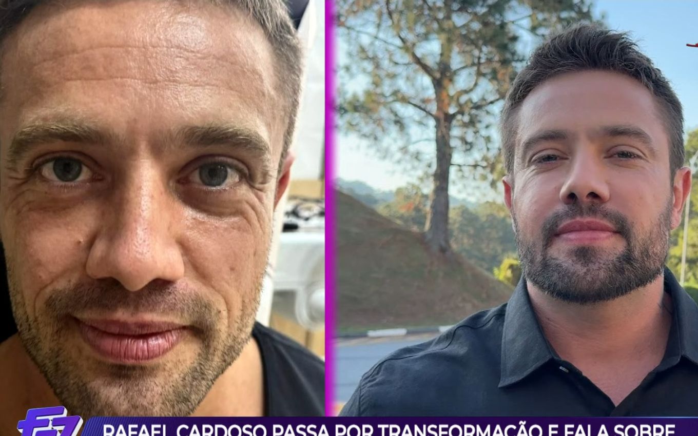 Antes e depois Rafael Cardoso