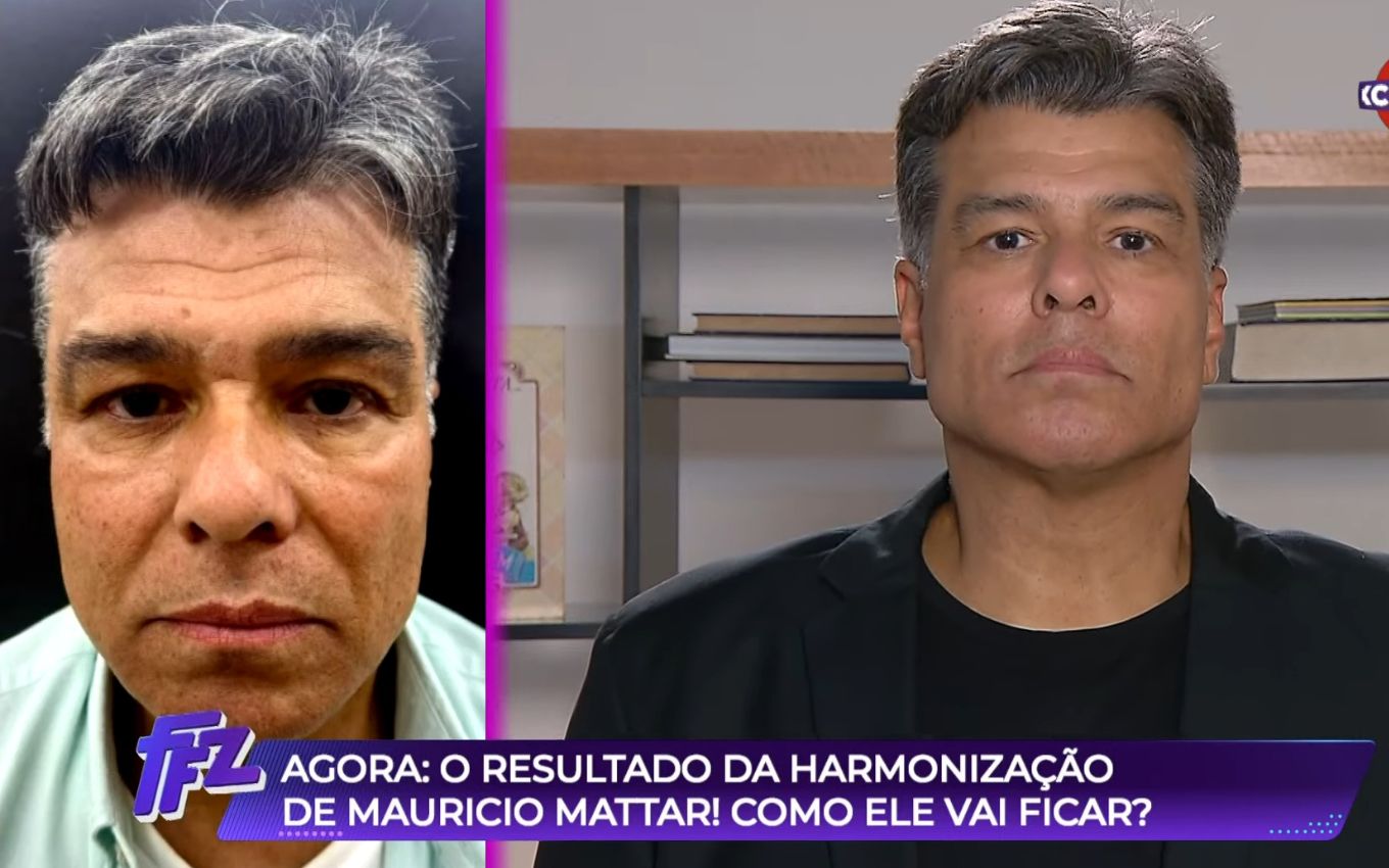 Harmonização Mauricio Mattar 